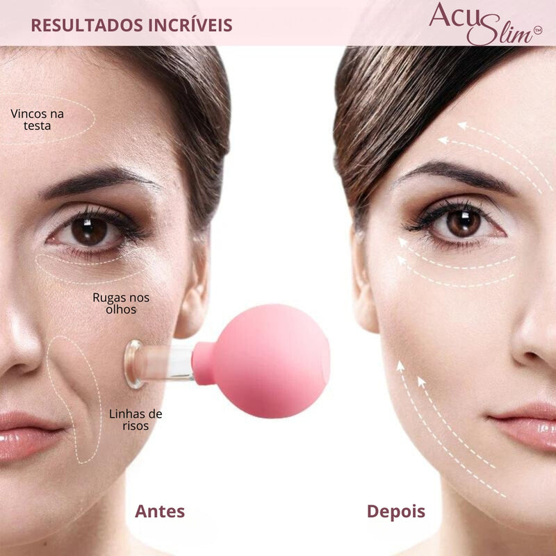 Ventosa para celulite e rejuvenescimento - AcuSlim™